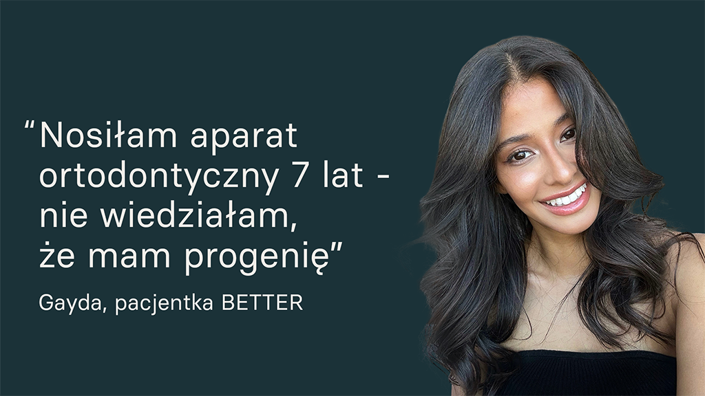 Historia pacjentki doktora Marka Rybickiego przed operacją ortognatyczną