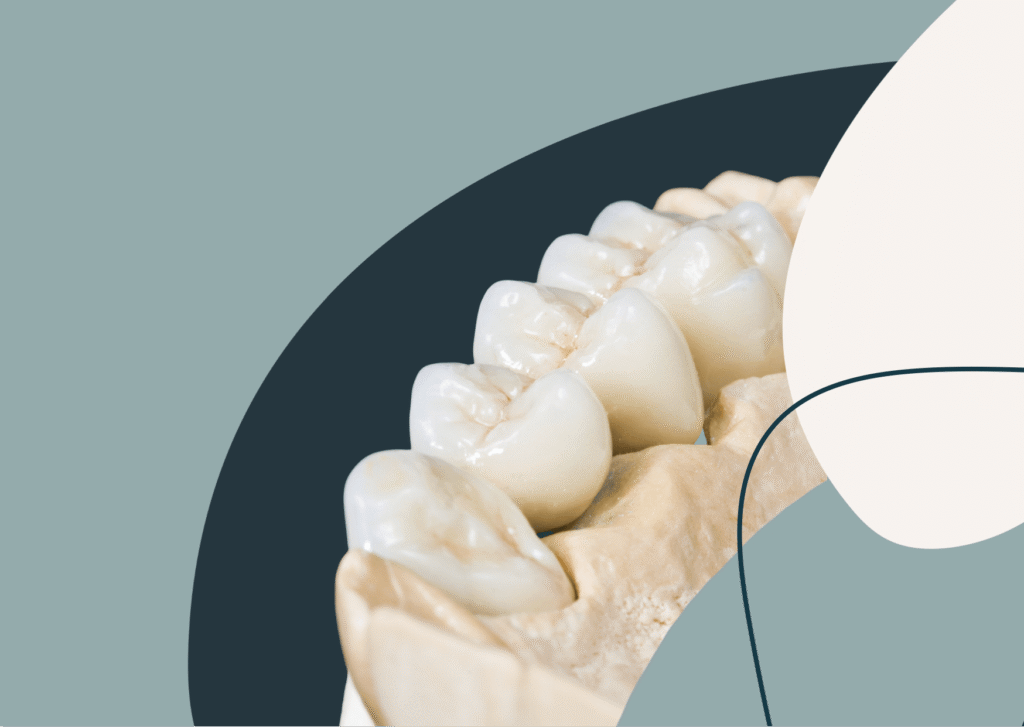 most protetyczny better warszawa