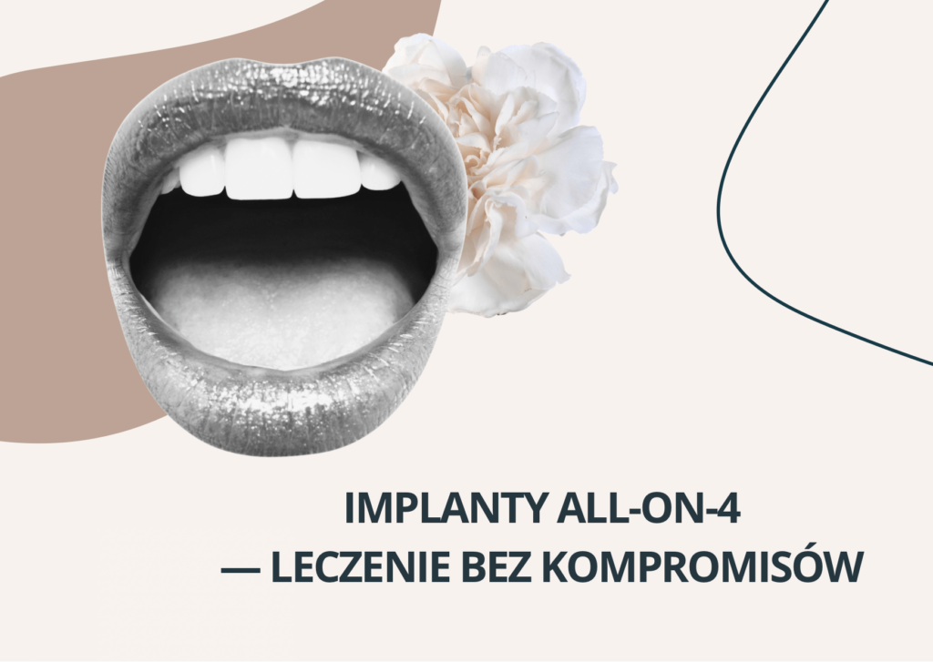 Implanty All-on-4