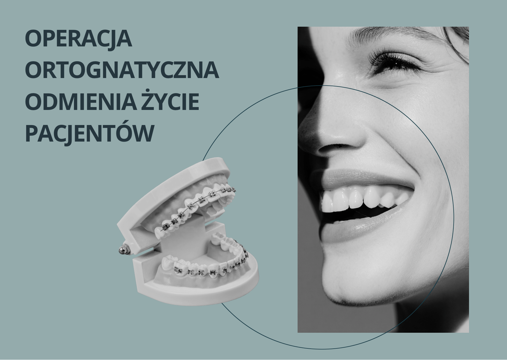 Operacja ortognatyczna