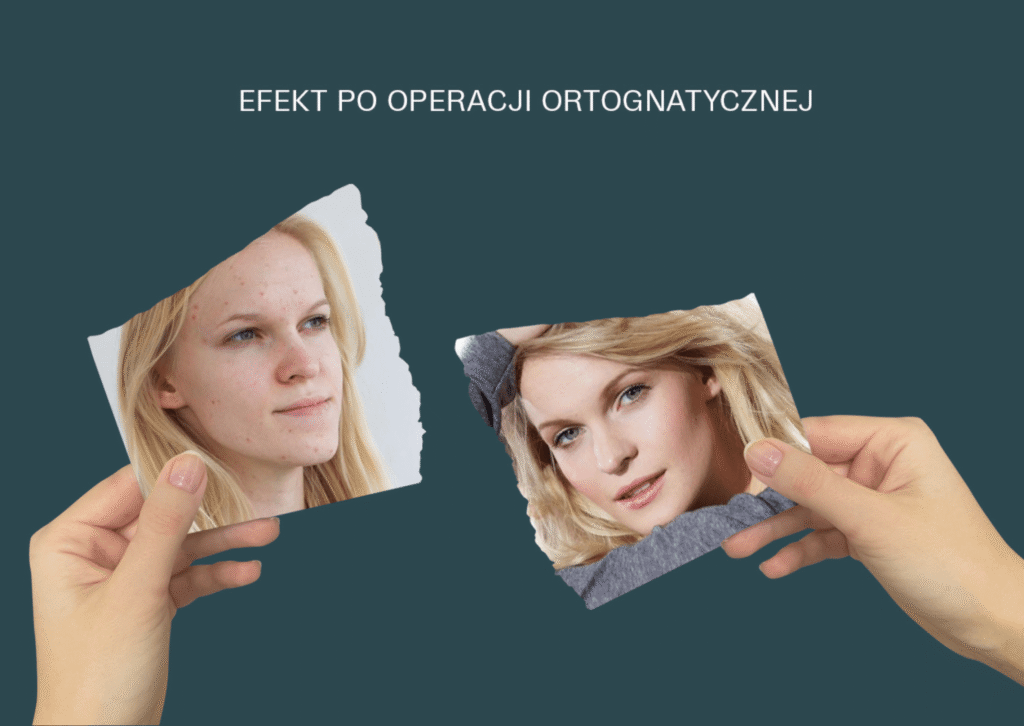 zabieg ortognatyczny przed i po