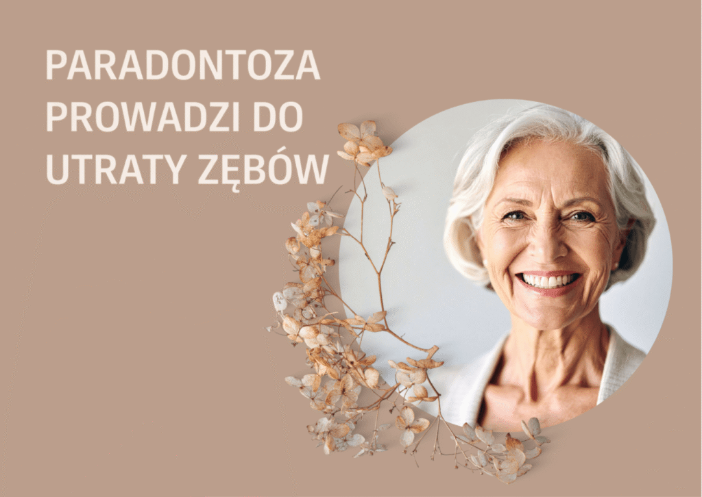 paradontoza prowadzi do utraty zębów