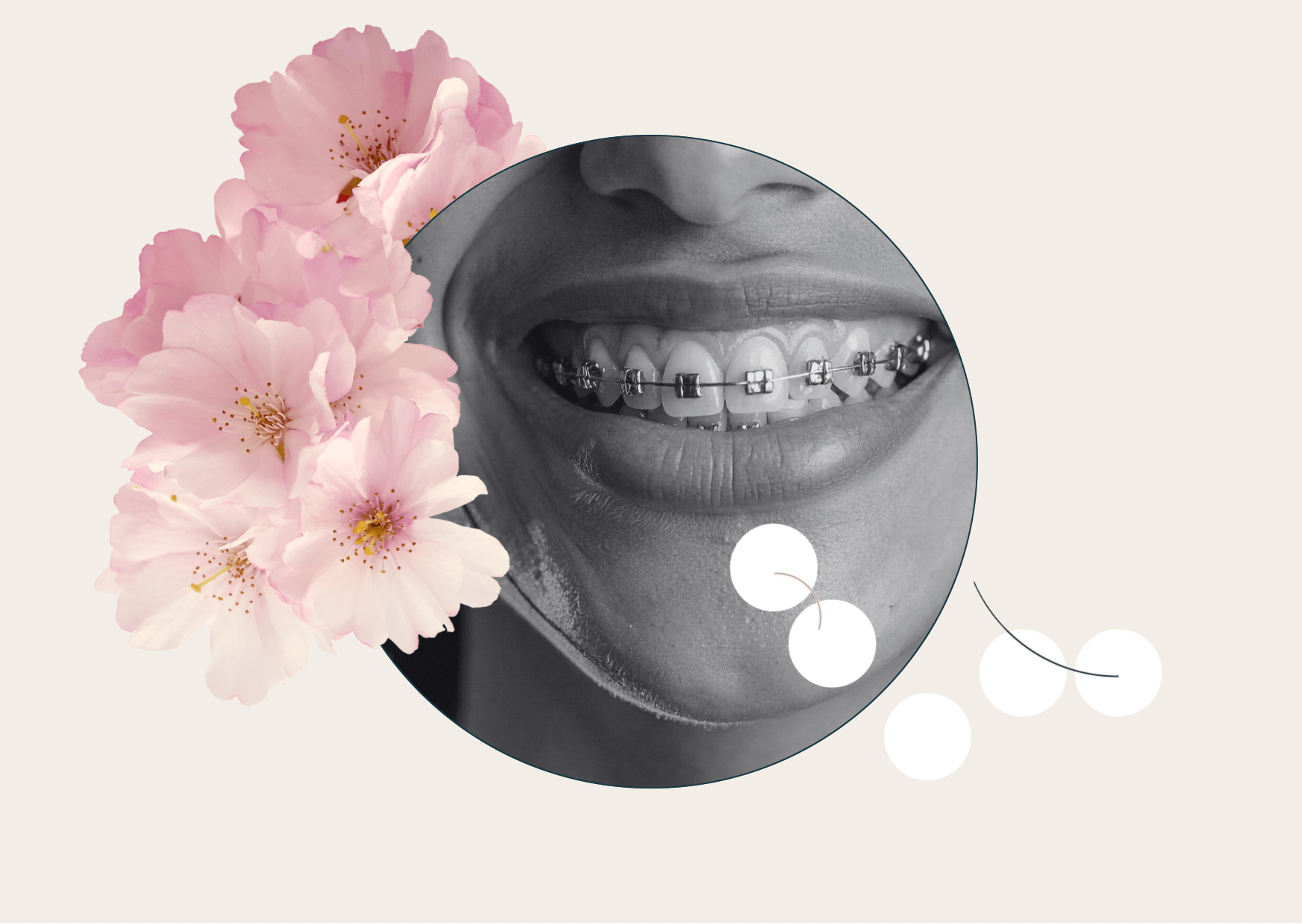 aparat na zęby better