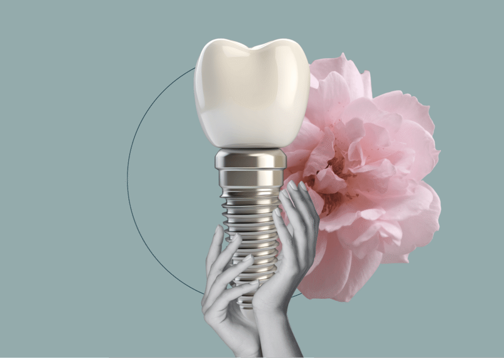 brak zęba można uzupełnić za pomocą implantu zębowego