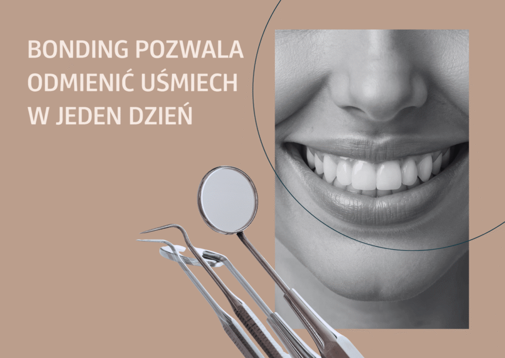bonding zębów 