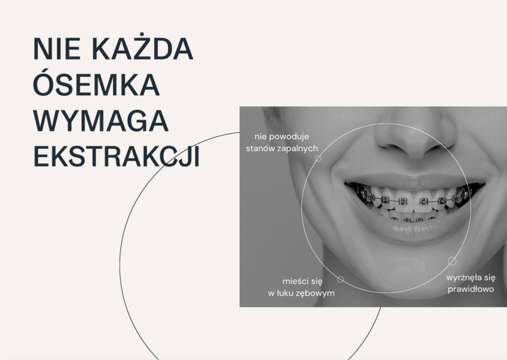 Usuwanie zatrzymanej ósemki w znieczuleniu miejscowym
