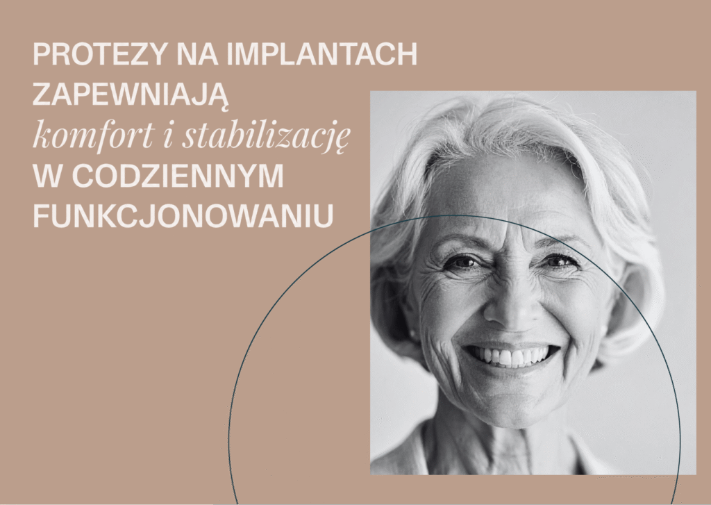 Proteza całkowita na implantach to uzupełnienie protetyczne mocowane do wszczepionych w kość implantów zębowych. 