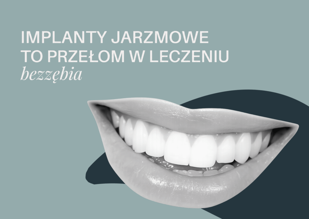 implanty jarzmowe — leczenie zaniku kości szczęki