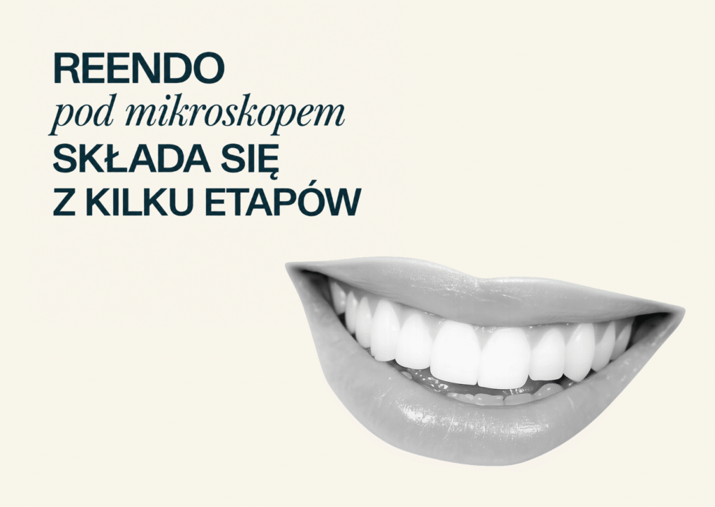 Reendo etapy — oczyszczanie i ponowne wypełnianie kanałów

